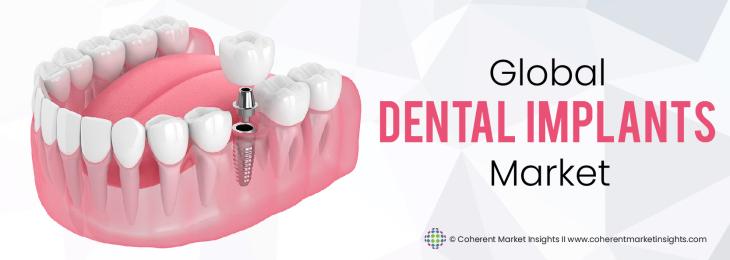 Prominent Players - Dental Implants Industry