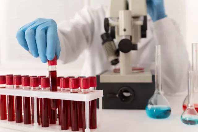 What Future Innovations Could Shape the Blood Culture Testing Industry