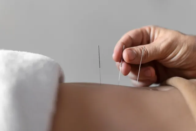 What is Driving the Global Adoption of Acupuncture Therapy