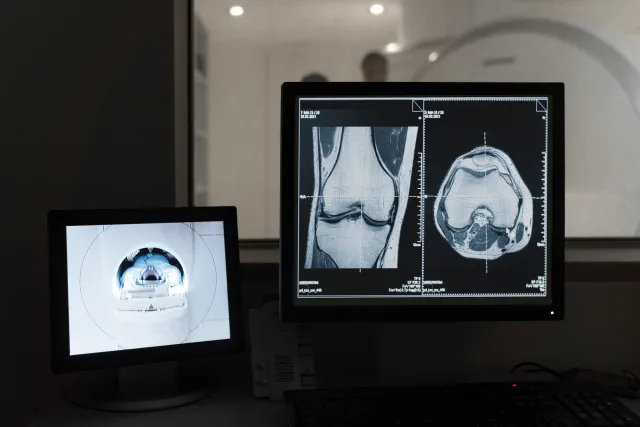 How Technological Advancements are Shaping the Future of Digital Radiography How Technological Advancements are Shaping the Future of Digital Radiography