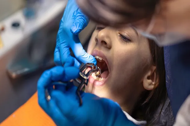 Dental Implant in Mumbai: A smarter way to replace