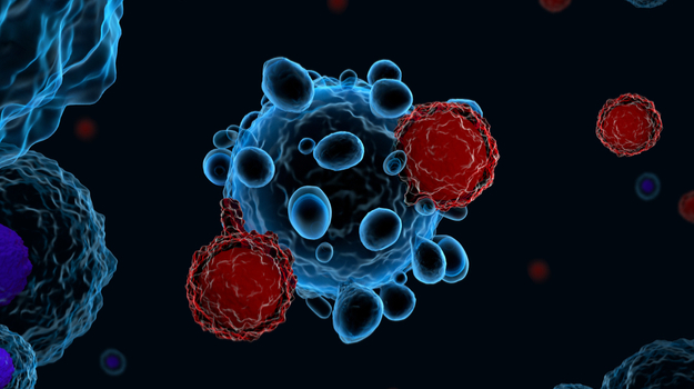 Cancerous T-Cells Using Car-T Therapy