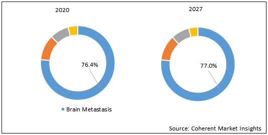 Gamma Knife Market Size, Trends And Forecast To 2027