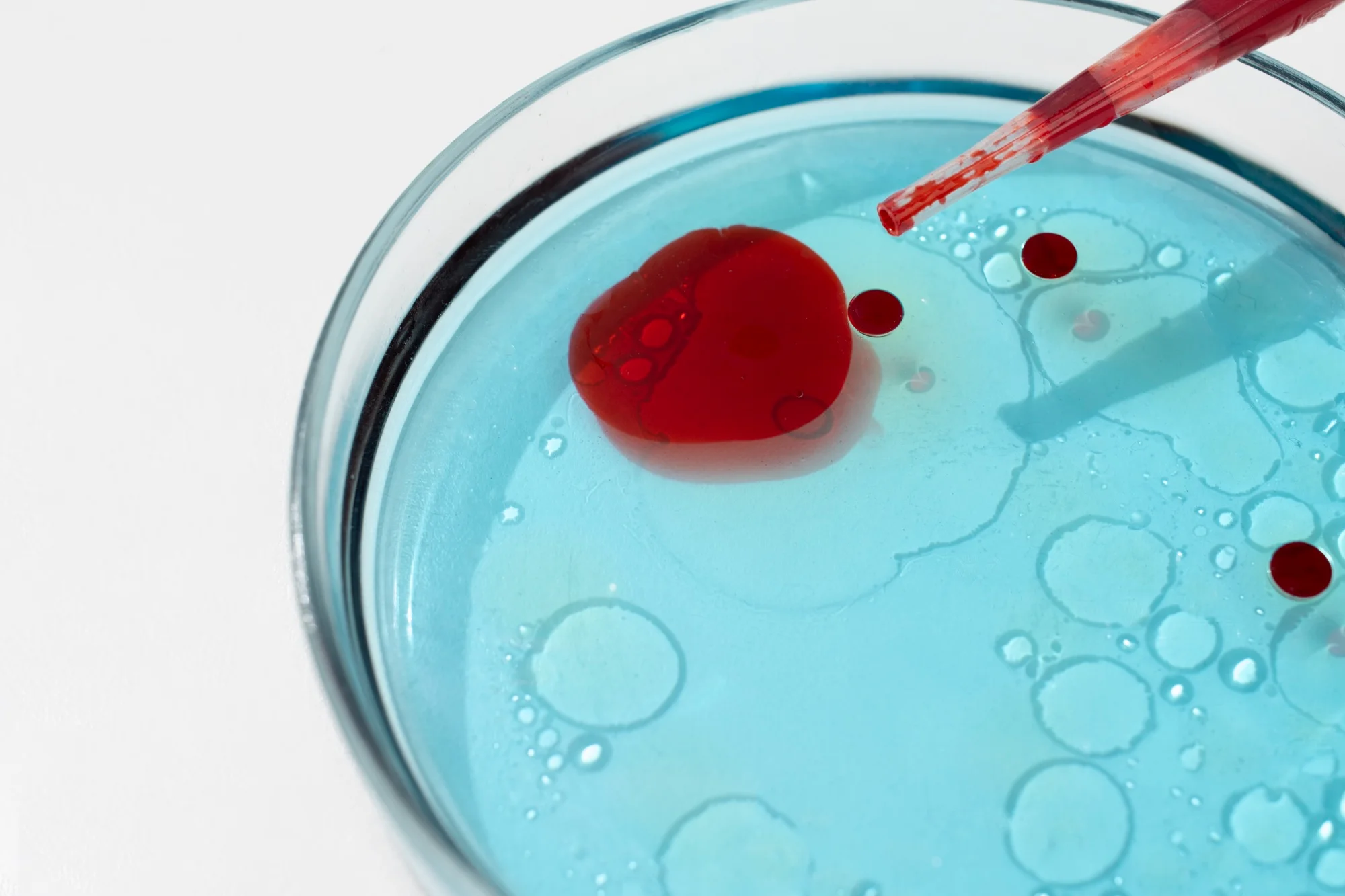 Demand for Blood Culture Tests in Diagnostics Drivers By Diagnostic System Technological 