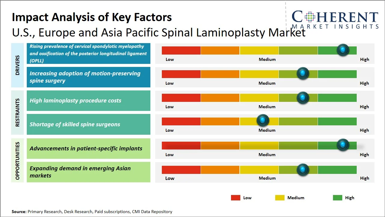 U.S., Europe and Asia Pacific Spinal Laminoplasty Market Key Factors U.S., Europe and Asia Pacific Spinal Laminoplasty Market Key Factors