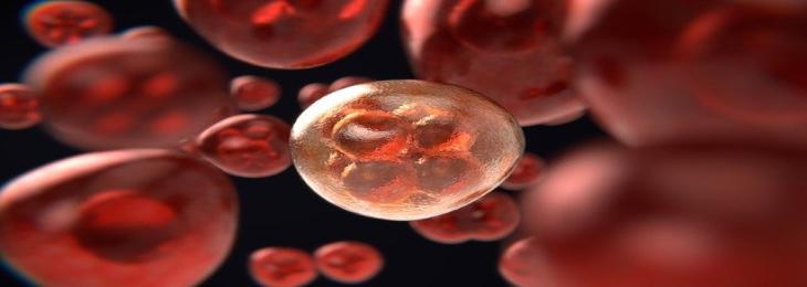 Preventing Rogue Blood Cells From Cloning Stops Blood Cancer