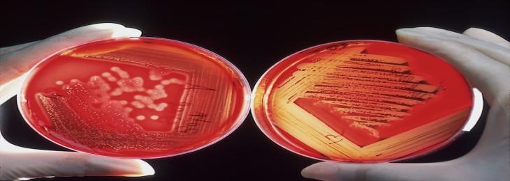 Early Attack On Immune Defences Is Made Possible By Poxvirus  Proteins