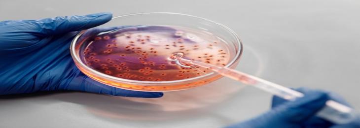 AI Aids Superbug Antibiotic Research